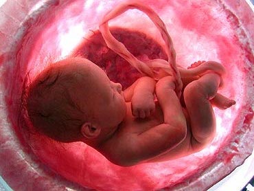 Fetal ultrasound