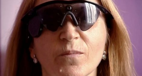 A year of artificial vision in Spain (Barcelona)