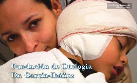 ПРОШЛО БОЛЕЕ 30 ЛЕТ ПОСЛЕ УСТАНОВКИ ПЕРВОГО КОХЛЕАРНОГО ИМПЛАНТАТ В ИСПАНИИ, ОСУЩЕСТВЛЕННАЯ ДОКТОРОМ ЭМИЛИО ГАРСИЯ-ИБАНЬЕЗ