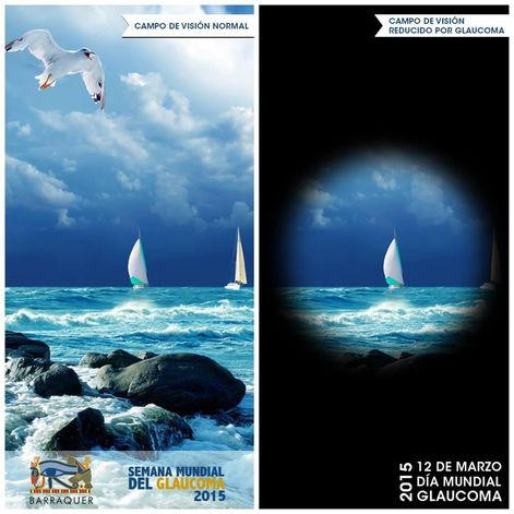 World Glaucoma Day