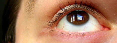 Ocular allergies and seasonal conjunctivitis