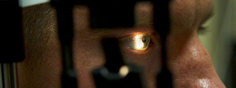 Get back to see after a cornea transplant